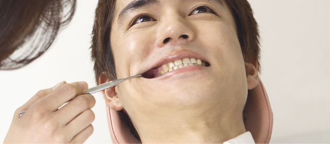 Iqosマウスクリーニング 浜松市の歯医者をお探しなら 飯島歯科医院